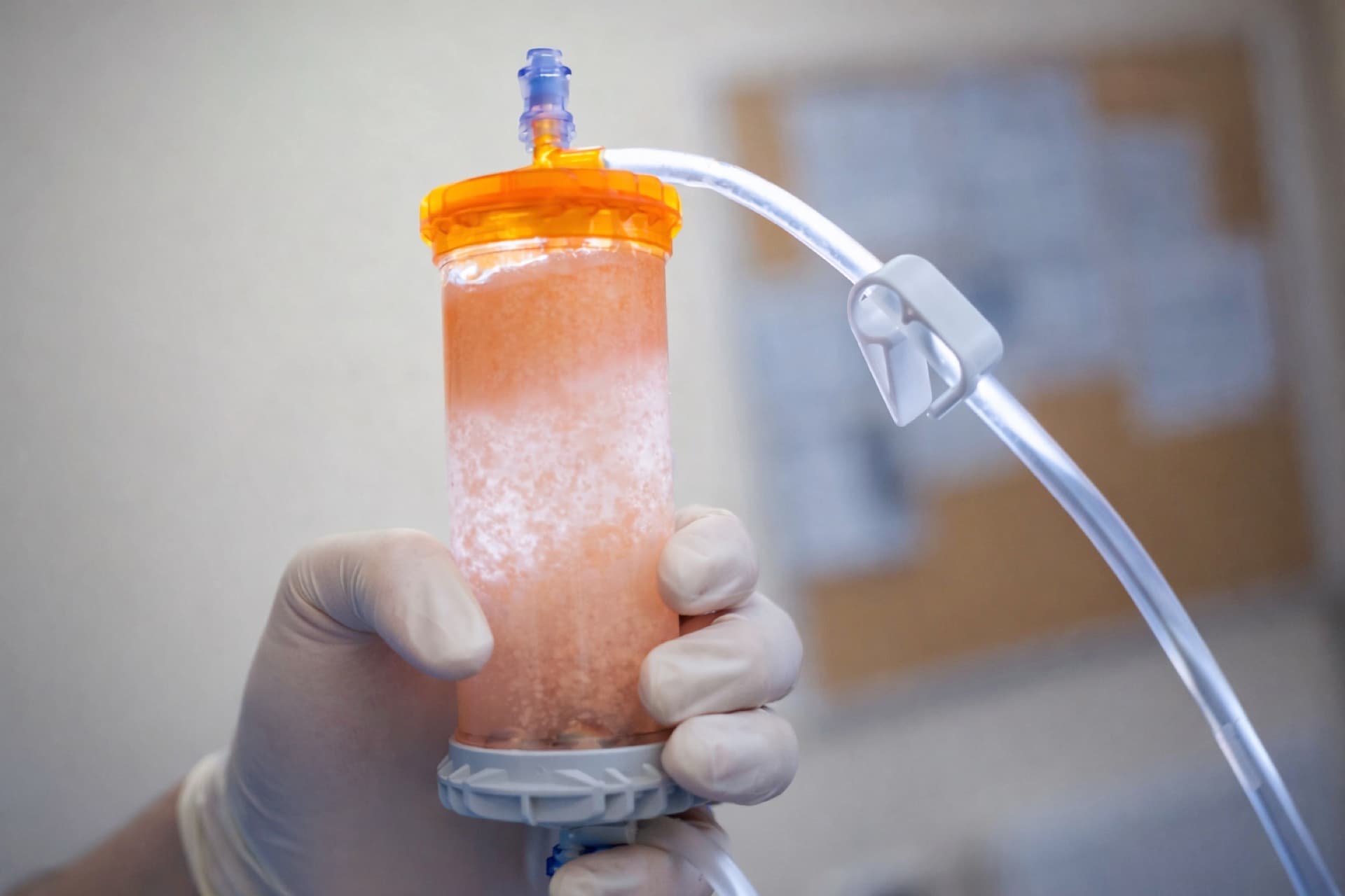 mFat treatment