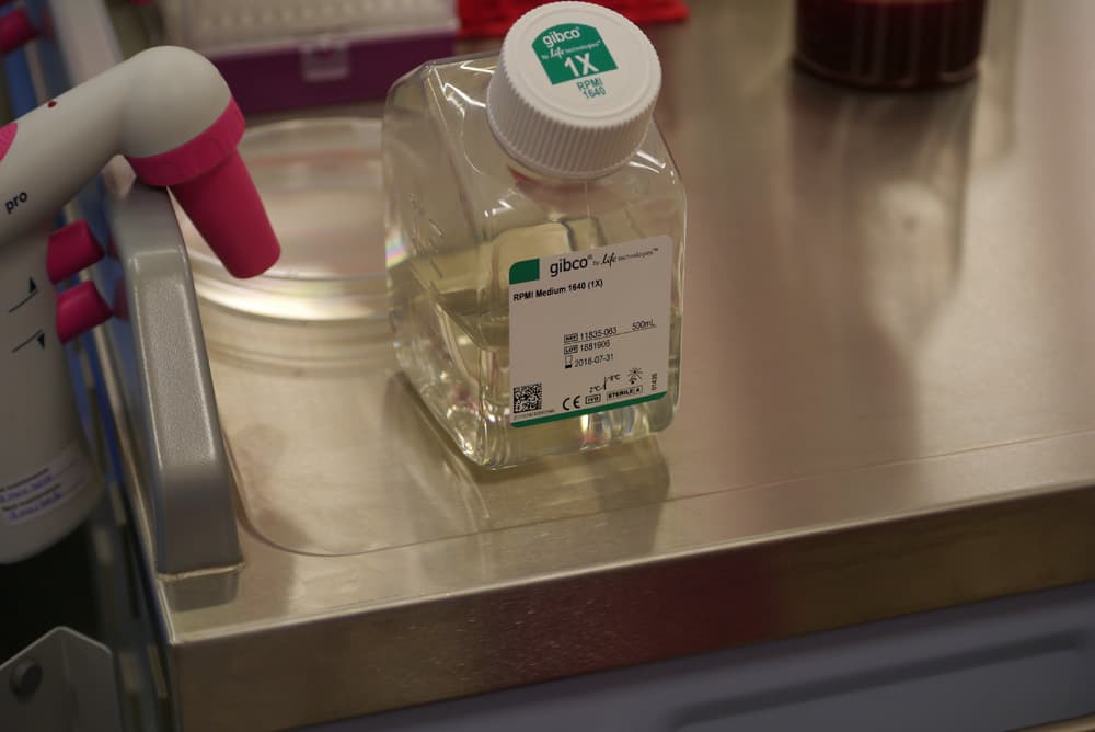 Cartilage cells prepared for cell therapy at London Cartilage Clinic
